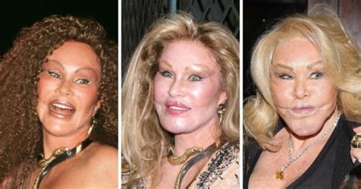 Jocelyn Wildenstein Before And After Plastic Surgery Young Photos- Where Is She Now?