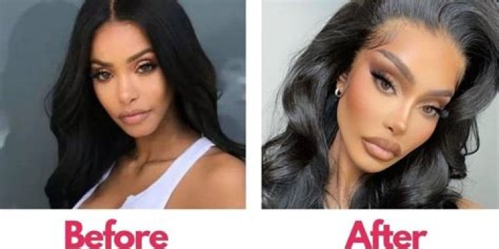 Jodie Joe Before And After Surgery Photos On Instagram, What Surgery Did She Have?