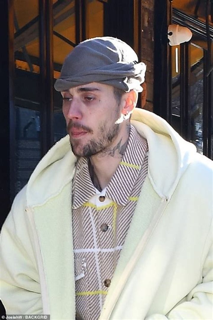 
Justin Bieber Is Still Alive | Death Hoax | Car Accident And Surgery Update 