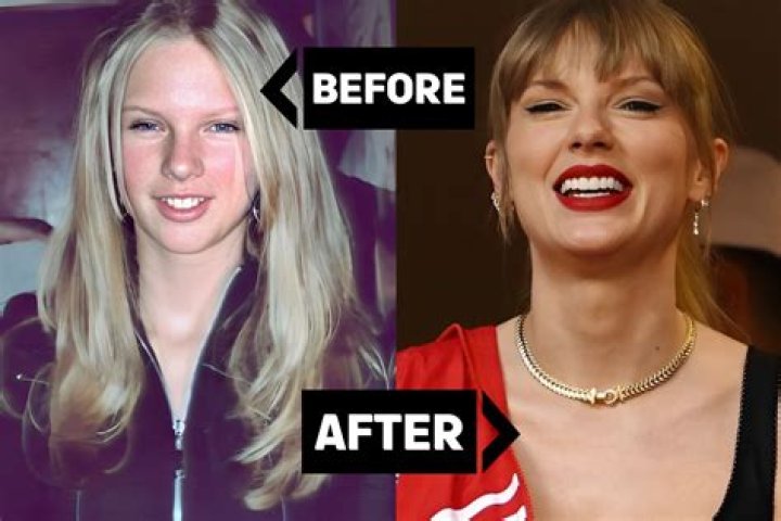 Matty Healy’s Teeth: Taylor Swift Fans Mock Matt For Having Crooked Teeth!